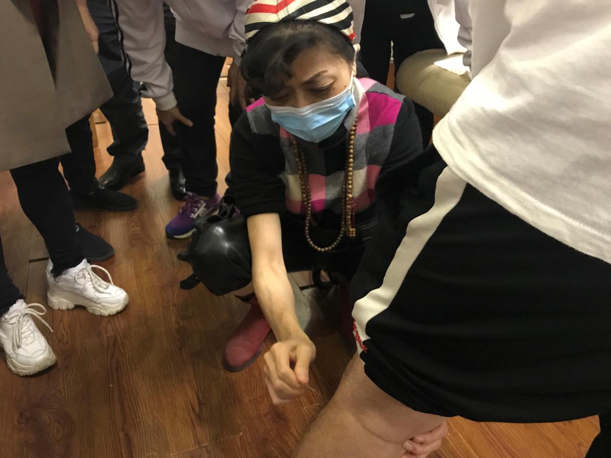 針灸能治療風濕性關節炎嗎？